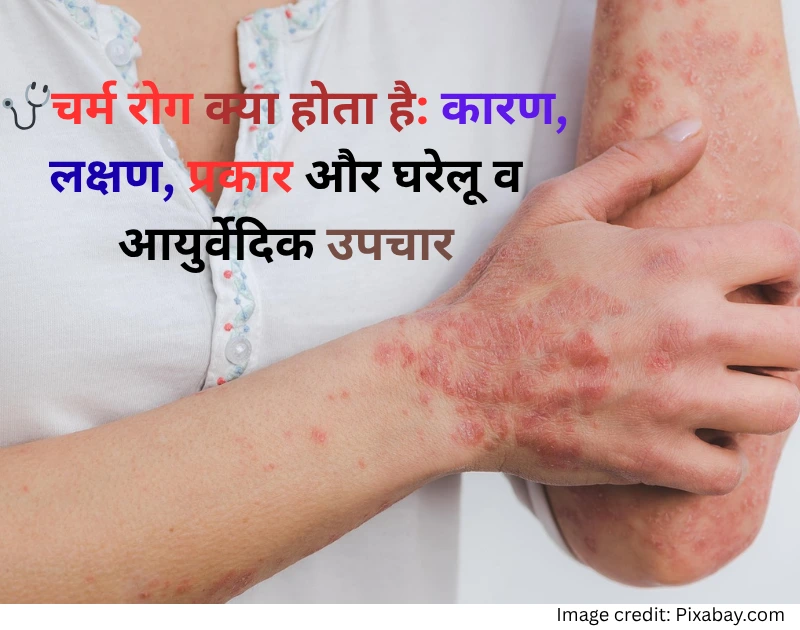 skin disease treatment in hindi
